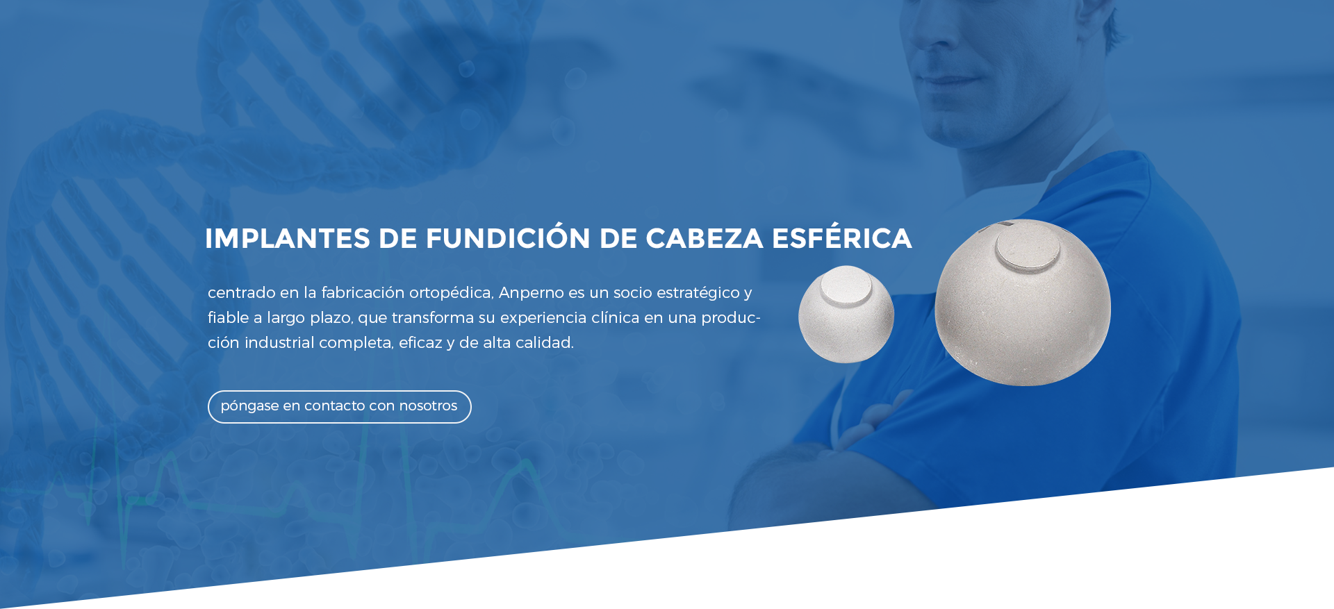 Implante de cabeza femoral (casting)